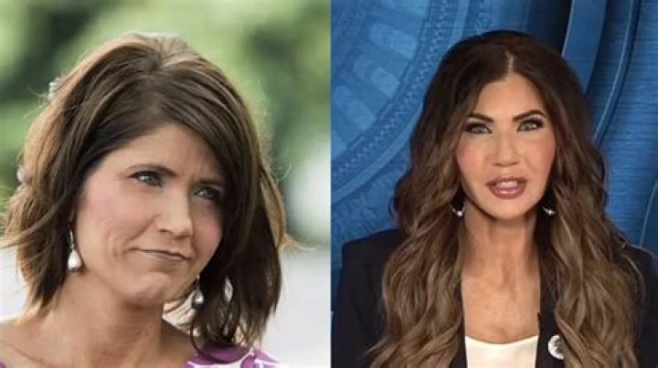 Unveiling The Truths Behind Hazel E's Plastic Surgery Journey